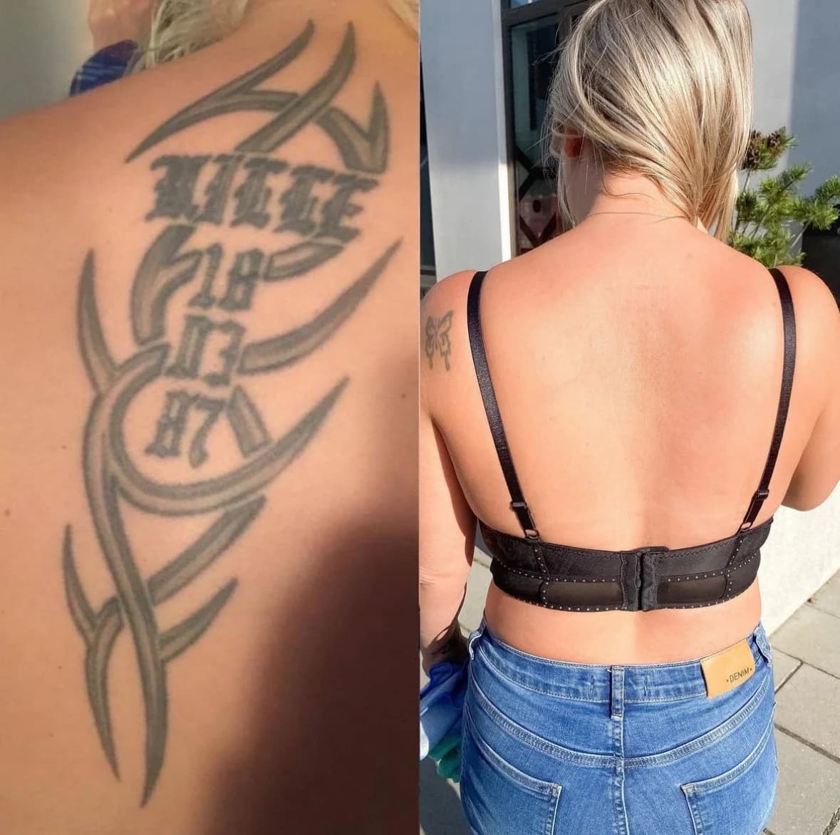 Før og efter tatoveringsfjernelse hos NUDE — ryggen helt ren efter endt forløb